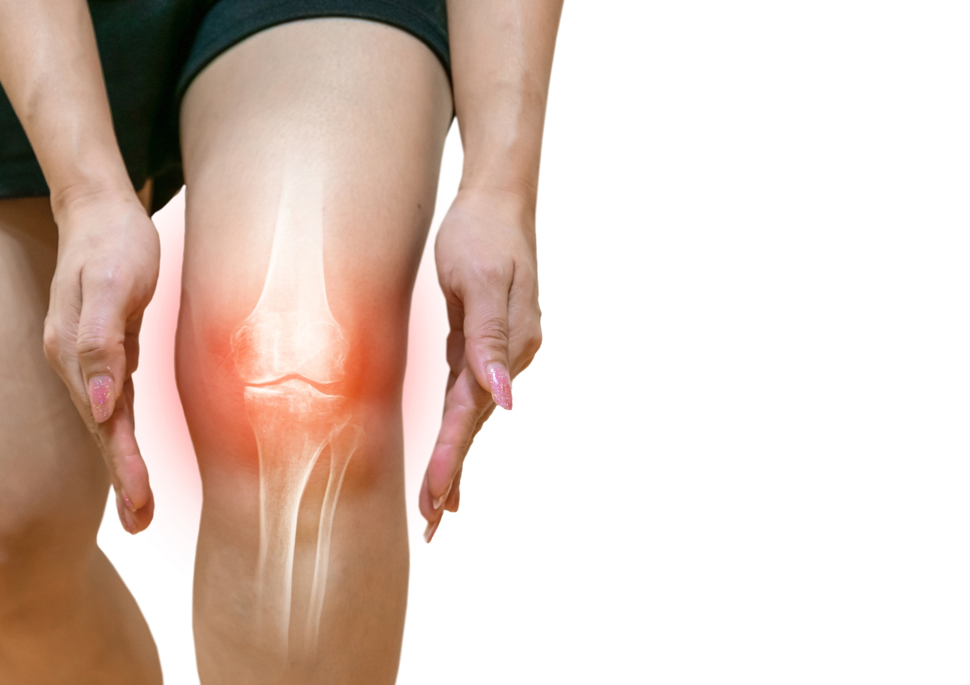 Arthrose_solution_naturelle_personnalise_naturopathe_Rose_des_Vents_Tolochenaz Arthrose_solution_naturelle_personnalise_naturopathe_Rose_des_Vents_Tolochenaz